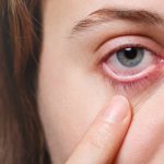 Homeopathic Medicine for Eye Vision Improvement: Safe, Natural Solutions