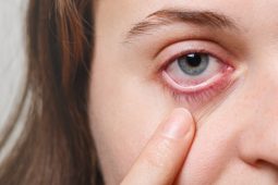 eye