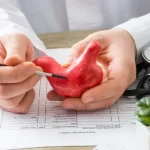 Gallbladder Stone Surgery in Hyderabad & Secunderabad: Your Complete Guide