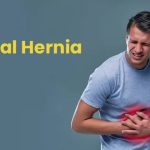 Inguinal Hernia: Types, Causes, Symptoms & Treatment