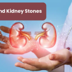 The Link Between Obesity and Kidney Stones
