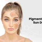Pigmentation and Sun Damage Treatment: All You Need to Know