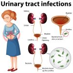 UTI Symptoms You Should Recognize and Treat Early
