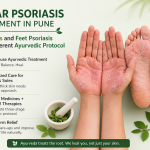 Palmar Psoriasis Treatment in Pune: Why Hands and Feet Psoriasis Needs a Different Ayurvedic Protocol