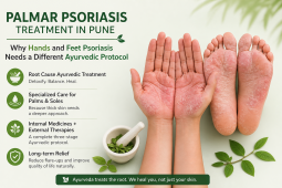 Palmar psoriasis on hands and feet with Ayurvedic treatment approach in Pune showing cracked dry skin and herbal healing elements