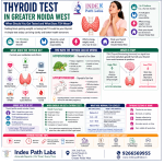 What Is a TSH Test?