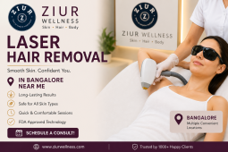 Laser Hair Removal in Bangalore Near Me