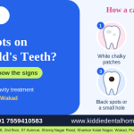 Why Do My Child’s Teeth Have Black Spots or Cavities?